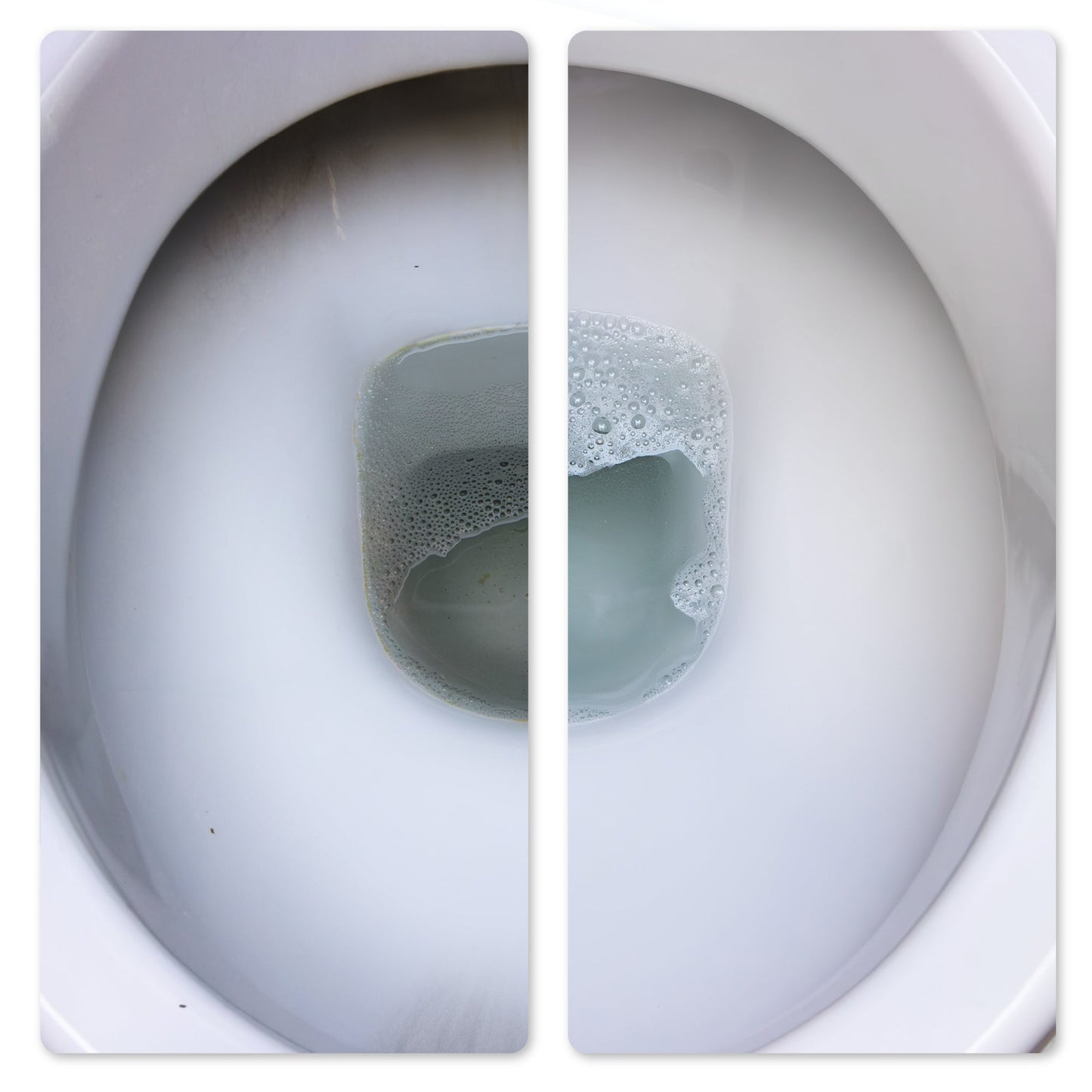 Liquide Nettoyant WC 1000Ml - Nettoyant pour Toilettes, Élimine le Calcaire et les Sédiments